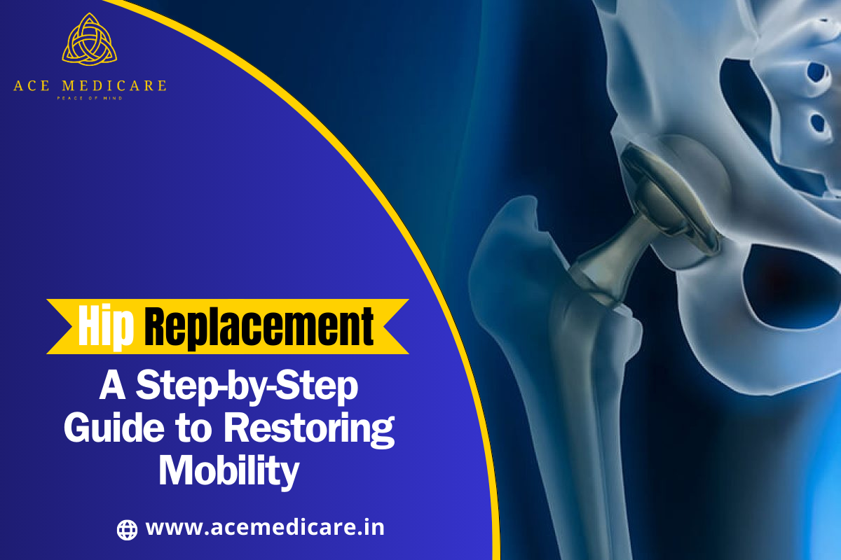 Hip Replacement Surgery: A Step-by-Step Guide to Restoring Mobility